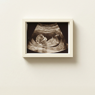 Obstetricia